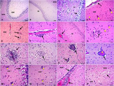 Brain Infection by Hepatitis E Virus Probably via Damage of the Blood-Brain Barrier Due to Alterations of Tight Junction Proteins